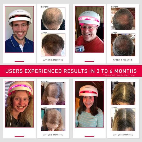 iRestore Essential Laser Hair Growth System - FDA Cleared Hair Loss Treatments for Men & Women & Hair Growth Products for Men with Thinning Hair, Hair Regrowth Treatments Laser Cap, Red Light Therapy